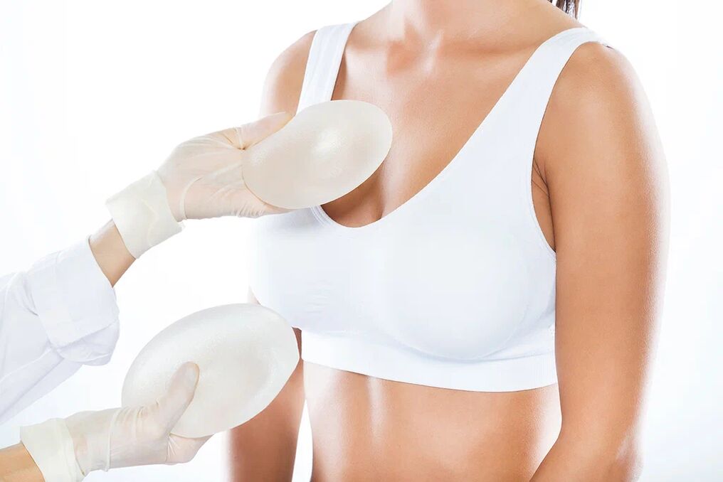 Dobór implantów przed zabiegiem powiększenia piersi
