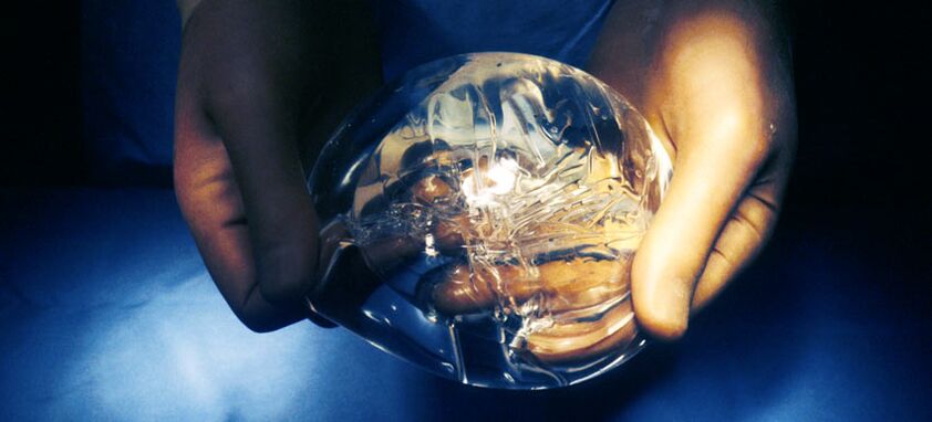 Endoproteza silikonowa