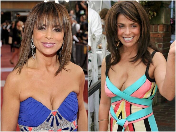 zdjęcia przed i po powiększeniu piersi